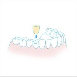 크라운 일러스트
