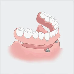치아구조 일러스트