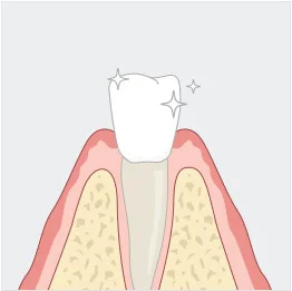 건강한 치아 일러스트